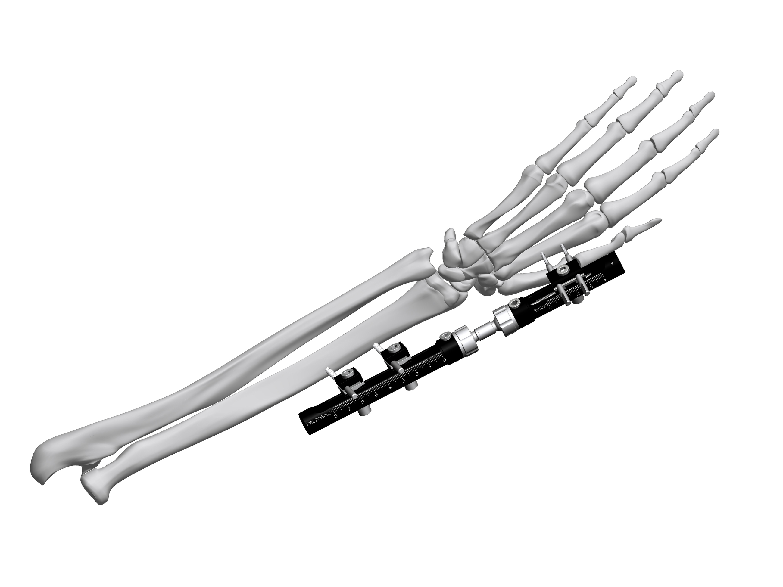 Wrist fixator