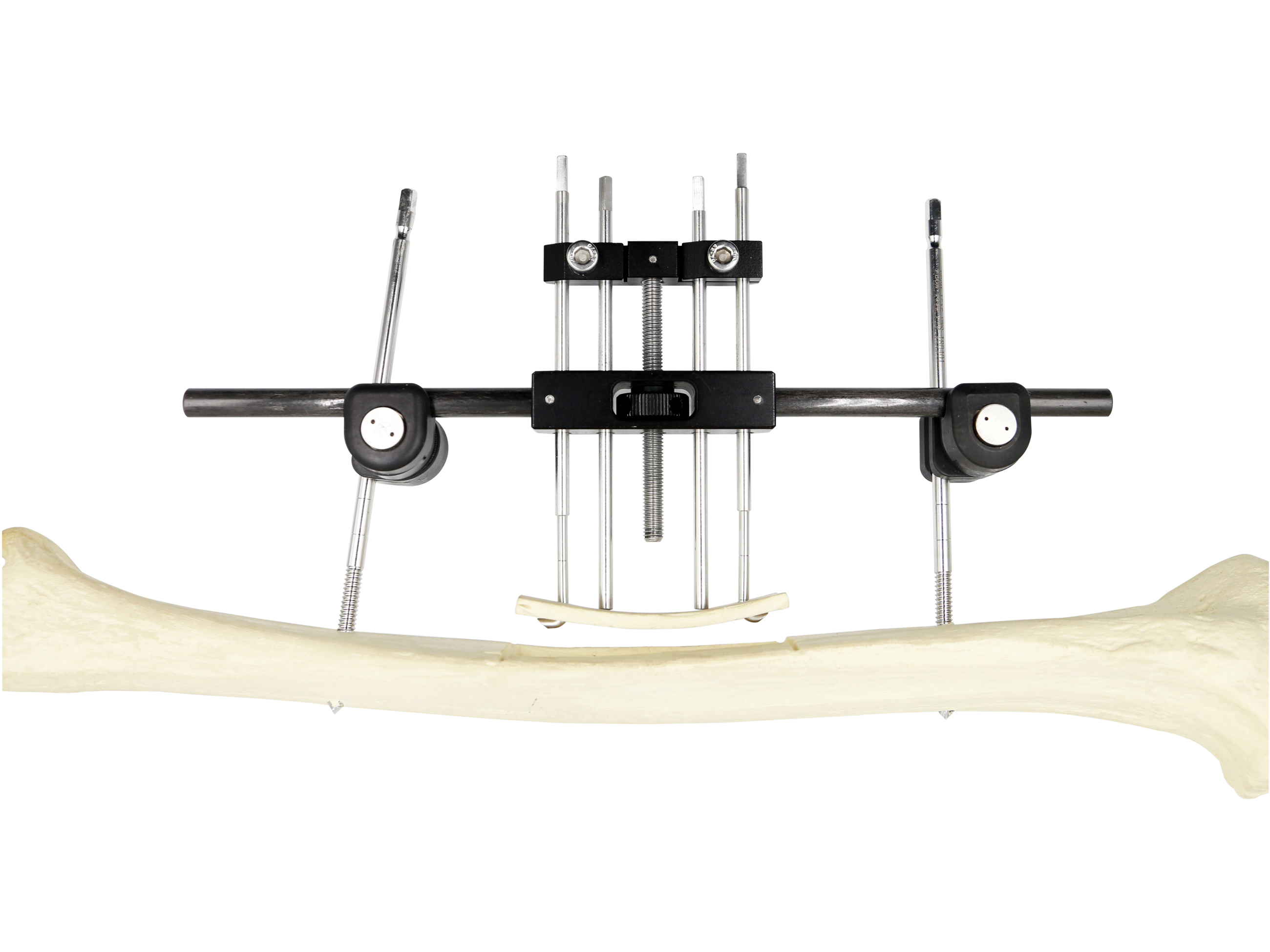 Lateral bone transfer bracket